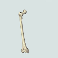 Протокол реабилитации при переломе бедренной кости (без операции)
