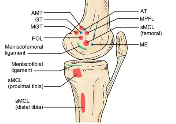 Травма медиальной коллатеральной связки колена. Протокол реабилитации без операции