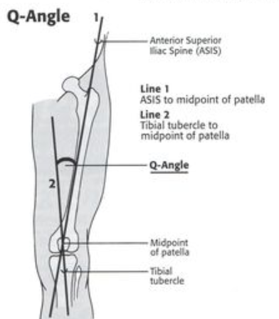 Травма медиальной коллатеральной связки колена: Протокол реабилитации без операции